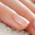 7 inexpensive ways to reduce nail fungus
