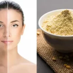 Pimples and blemishes will disappear in a few days, just mix this one thing in gram flour, then get feeding face