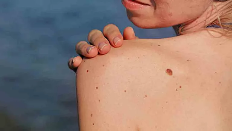 skincare: skin irritation, what is the way?