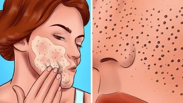 8 Skincare Mistakes Th at Are Making Your Pores Look Larger