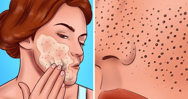 8 Skincare Mistakes Th at Are Making Your Pores Look Larger