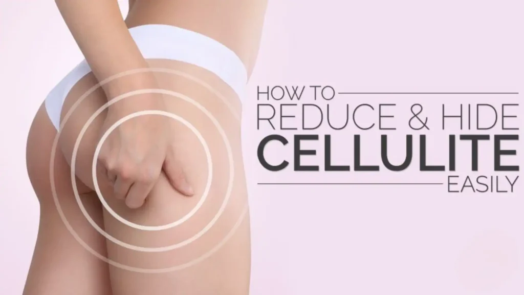 how to hide cellulite on legs