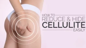 how to hide cellulite on legs