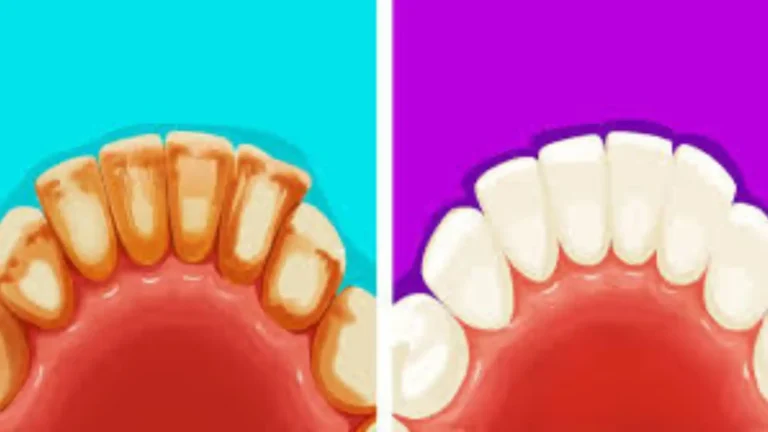 6 Effective Natural Methods for Removing Dental Plaque