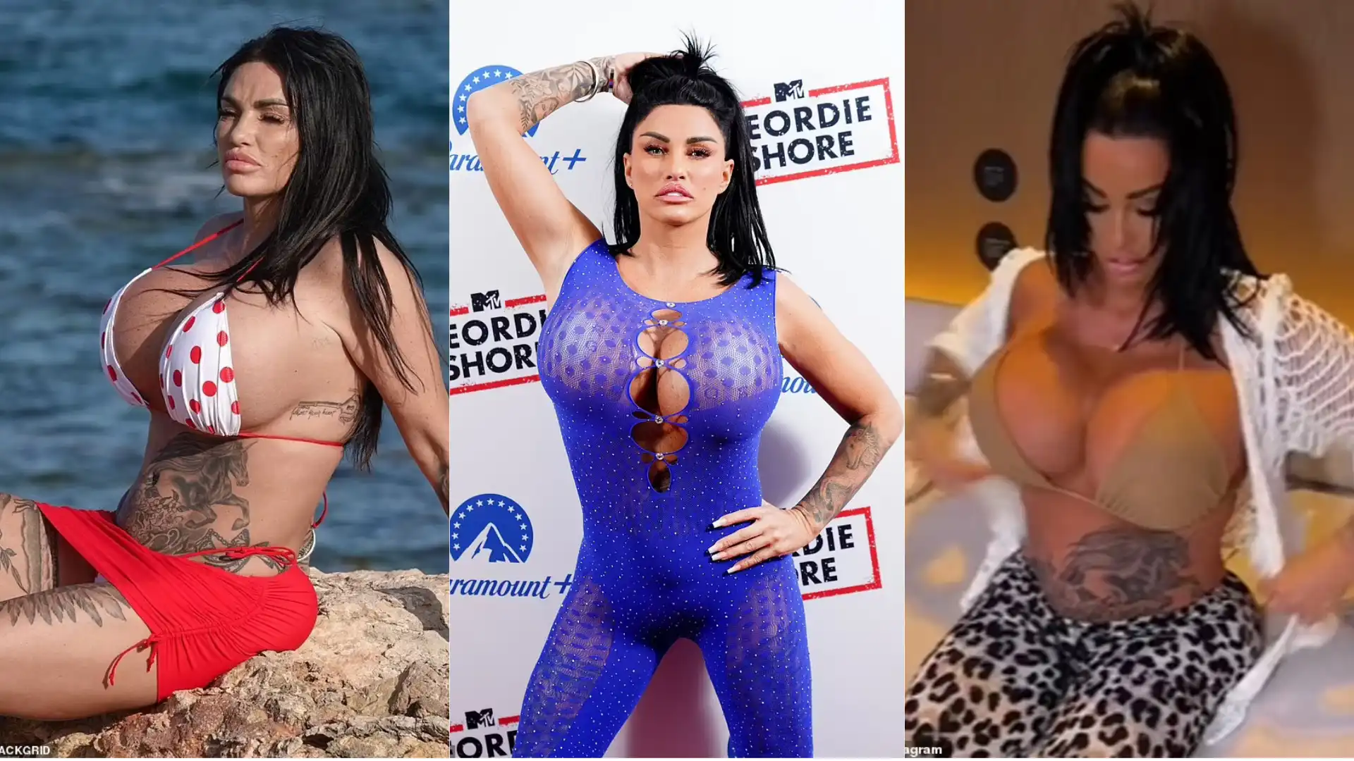 Katie Price breast surgery