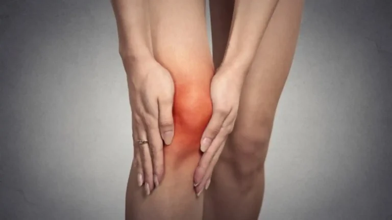 Understanding Rheumatoid Arthritis