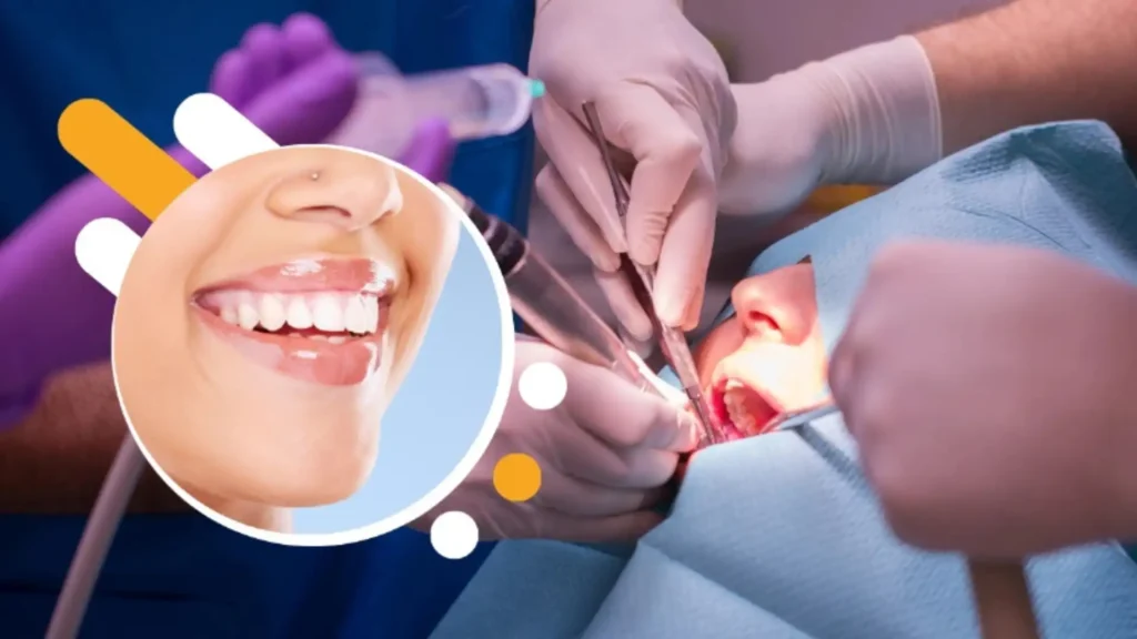 Unlock Your Perfect Smile: The Maryland Bridge Solution for Missing Teeth