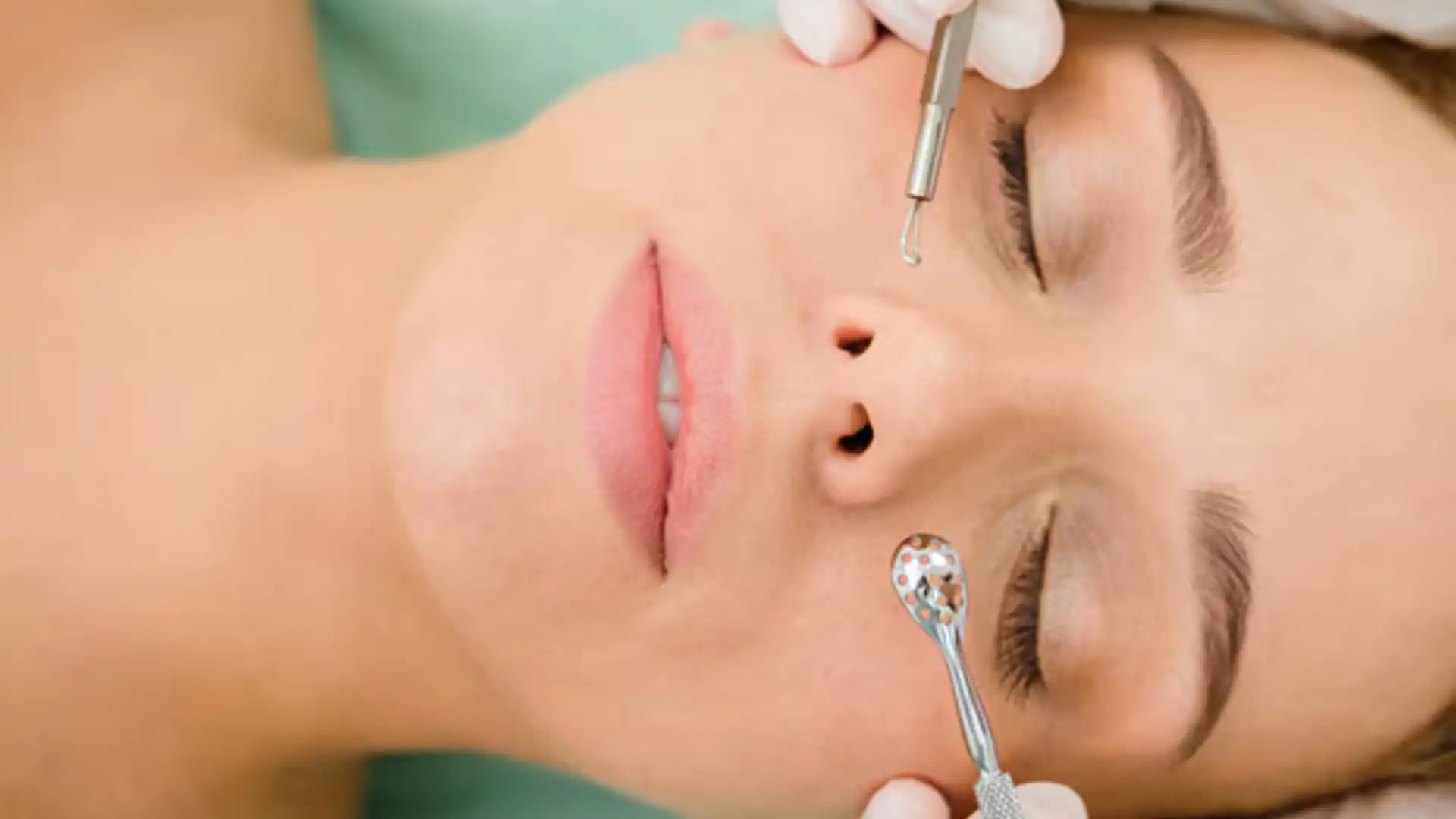 How to Remove Blackheads Safely Expert Tips and Tricks