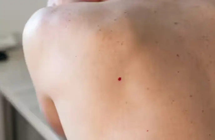 red spots on skin