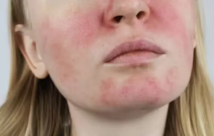 red spots on skin