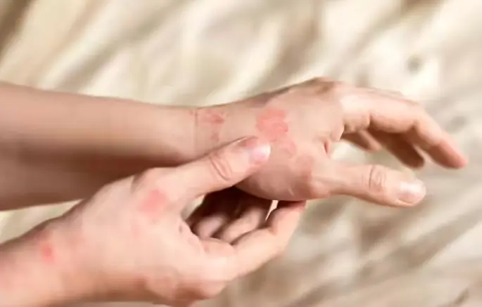 red spots on skin