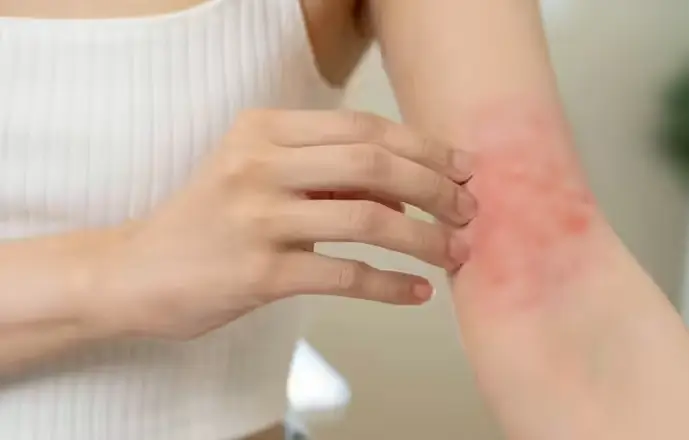 red spots on skin